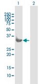 Anti-SDCBP antibody produced in mouse purified immunoglobulin, buffered aqueous solution