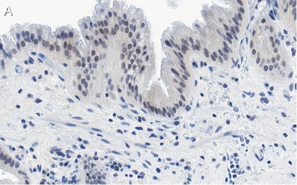 Anti-Nrf2 Antibody, clone 5B20 ZooMAb&#174; Rabbit Monoclonal recombinant, expressed in HEK 293 cells