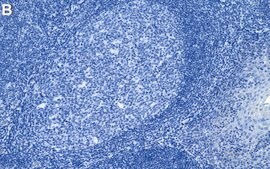 Anti-PCNA Antibody, clone PC10 ZooMAb® Mouse Monoclonal recombinant, expressed in HEK 293 cells