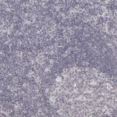 Anti-KIAA1210 antibody produced in rabbit Prestige Antibodies&#174; Powered by Atlas Antibodies, affinity isolated antibody, buffered aqueous glycerol solution