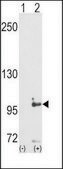 Anti-MCK10 (C-term) antibody produced in rabbit IgG fraction of antiserum, buffered aqueous solution