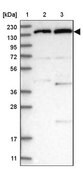 Anti-POLR2B antibody produced in rabbit Prestige Antibodies® Powered by Atlas Antibodies, affinity isolated antibody, buffered aqueous glycerol solution