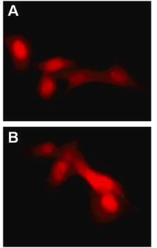 LentiBrite RFP-LC3 Control Mutant Lentiviral Biosensor