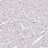 Anti-PPP2R2B antibody produced in rabbit Prestige Antibodies&#174; Powered by Atlas Antibodies, affinity isolated antibody, buffered aqueous glycerol solution