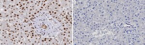 Anti-TBX4 Antibody, clone 2B18 ZooMAb&#174; Rabbit Monoclonal recombinant, expressed in HEK 293 cells