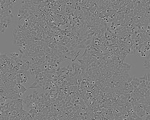 HCT 116 Cell Line human NOTE: Both the cell line and DNA from the cell line may be available for this product. Please choose -1VL or VIAL for cells, or -DNA-5UG for DNA, 91091005, human colon, Epithelial-like