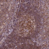 Anti-IRAK3 antibody produced in rabbit Prestige Antibodies&#174; Powered by Atlas Antibodies, affinity isolated antibody, buffered aqueous glycerol solution