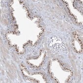Anti-AFTPH antibody produced in rabbit Prestige Antibodies&#174; Powered by Atlas Antibodies, affinity isolated antibody, buffered aqueous glycerol solution