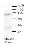 Anti-LSS (AB1) antibody produced in rabbit affinity isolated antibody