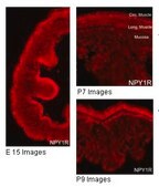 Anti-NPY1R antibody produced in rabbit affinity isolated antibody