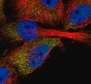 Anti-ABHD2 antibody produced in rabbit Prestige Antibodies® Powered by Atlas Antibodies, affinity isolated antibody, buffered aqueous glycerol solution