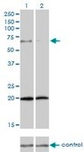 Monoclonal Anti-ZYX antibody produced in mouse clone 2C10-4A7, purified immunoglobulin, buffered aqueous solution
