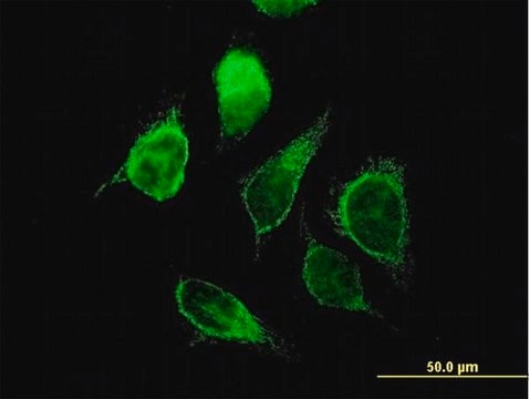 Anti-ECHS1 antibody produced in mouse purified immunoglobulin, buffered aqueous solution