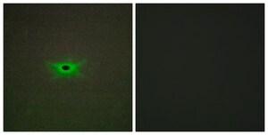 Anti-PRKAG2 antibody produced in rabbit affinity isolated antibody