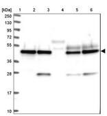 Anti-SNX15 antibody produced in rabbit Prestige Antibodies&#174; Powered by Atlas Antibodies, affinity isolated antibody, buffered aqueous glycerol solution