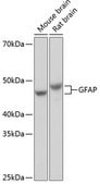 Anti-GFAP Antibody, clone 8M2F9, Rabbit Monoclonal