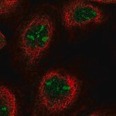 Anti-ANKRD18A antibody produced in rabbit Prestige Antibodies® Powered by Atlas Antibodies, affinity isolated antibody, buffered aqueous glycerol solution