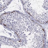 Anti-LRRD1 antibody produced in rabbit Prestige Antibodies&#174; Powered by Atlas Antibodies, affinity isolated antibody, buffered aqueous glycerol solution