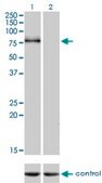 Monoclonal Anti-CDH6 antibody produced in mouse clone 2F2, purified immunoglobulin, buffered aqueous solution