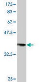 Monoclonal Anti-RAD18 antibody produced in mouse clone 2B9, purified immunoglobulin, buffered aqueous solution