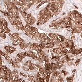 Monoclonal Anti-Msln Antibody Produced In Mouse Prestige Antibodies® Powered by Atlas Antibodies, clone CL13965, affinity isolated antibody, buffered aqueous glycerol solution
