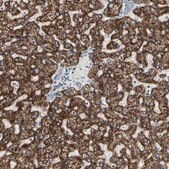 Anti-TMEM176A antibody produced in rabbit Prestige Antibodies® Powered by Atlas Antibodies, affinity isolated antibody, buffered aqueous glycerol solution