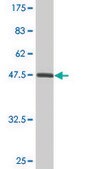 Monoclonal Anti-HSD11B1 antibody produced in mouse clone 2C10, ascites fluid