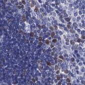 Anti-KIF2C antibody produced in rabbit Prestige Antibodies&#174; Powered by Atlas Antibodies, affinity isolated antibody, buffered aqueous glycerol solution