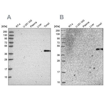 Anti-SULT2B1 antibody produced in rabbit Prestige Antibodies&#174; Powered by Atlas Antibodies, affinity isolated antibody, buffered aqueous glycerol solution