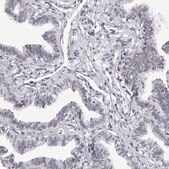 Anti-GNL2 antibody produced in rabbit Prestige Antibodies&#174; Powered by Atlas Antibodies, affinity isolated antibody, buffered aqueous glycerol solution