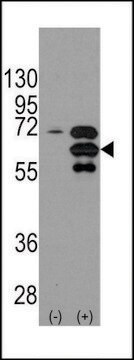 ANTI-INA (ALPHA INTERNEXIN) (CENTER) antibody produced in rabbit IgG fraction of antiserum, buffered aqueous solution