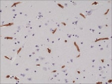 Anti-CD29 antibody, Rabbit Monoclonal recombinant, expressed in HEK 293 cells, clone RM285, purified immunoglobulin