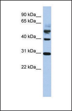 Anti-TTL antibody produced in rabbit affinity isolated antibody