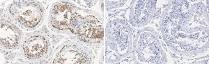 Anti-MGMT Antibody, clone 2N19 ZooMAb® Rabbit Monoclonal recombinant, expressed in HEK 293 cells