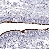 Anti-CCDC181 antibody produced in rabbit Prestige Antibodies® Powered by Atlas Antibodies, affinity isolated antibody, buffered aqueous glycerol solution, ab1