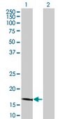 Monoclonal Anti-LCN1 antibody produced in mouse clone 1B11, purified immunoglobulin, buffered aqueous solution