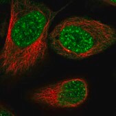 Anti-RSRC2 antibody produced in rabbit Prestige Antibodies&#174; Powered by Atlas Antibodies, affinity isolated antibody, buffered aqueous glycerol solution