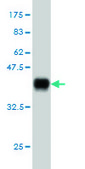 Monoclonal Anti-STK38 antibody produced in mouse clone 3A5, purified immunoglobulin, buffered aqueous solution
