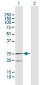 Anti-MRPL12 antibody produced in rabbit purified immunoglobulin, buffered aqueous solution