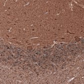 Monoclonal Anti-TUBB3 antibody produced in mouse Prestige Antibodies&#174; Powered by Atlas Antibodies, clone CL5813, purified immunoglobulin, buffered aqueous glycerol solution