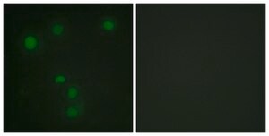 Anti-Retinoblastoma antibody produced in rabbit affinity isolated antibody