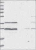 Anti-TADA1 antibody produced in rabbit Prestige Antibodies® Powered by Atlas Antibodies, affinity isolated antibody, buffered aqueous glycerol solution