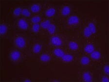 Estrogen Receptor Alpha and STUB1 PLA® Antibody Kit Powered by Bethyl Laboratories, Inc.