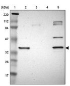 Anti-SDSL antibody produced in rabbit Prestige Antibodies&#174; Powered by Atlas Antibodies, affinity isolated antibody, buffered aqueous glycerol solution