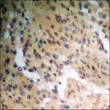 Anti-phospho-Parkin (pSer131) antibody produced in rabbit affinity isolated antibody