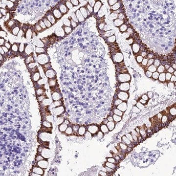 Anti-TRAM1L1 antibody produced in rabbit Prestige Antibodies&#174; Powered by Atlas Antibodies, affinity isolated antibody, buffered aqueous glycerol solution