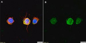 Anti-Proteinase 3/PR3 Antibody, clone 1L13 ZooMAb&#174; Rabbit Monoclonal recombinant, expressed in HEK 293 cells