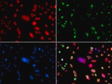 Anti- RAG2 antibody produced in rabbit