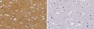 Anti-RhoA Antibody, clone 1K8 ZooMAb&#174; Rabbit Monoclonal recombinant, expressed in HEK 293 cells