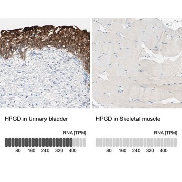 Anti-HPGD antibody produced in rabbit Prestige Antibodies® Powered by Atlas Antibodies, affinity isolated antibody, buffered aqueous glycerol solution
